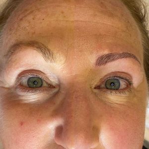 Cosmetic Eyebrow Tattoo Before and After