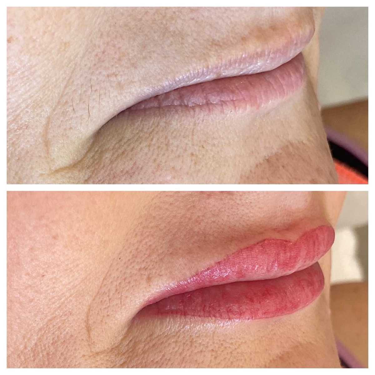 Cosmetic Lip Tattoo Before and After