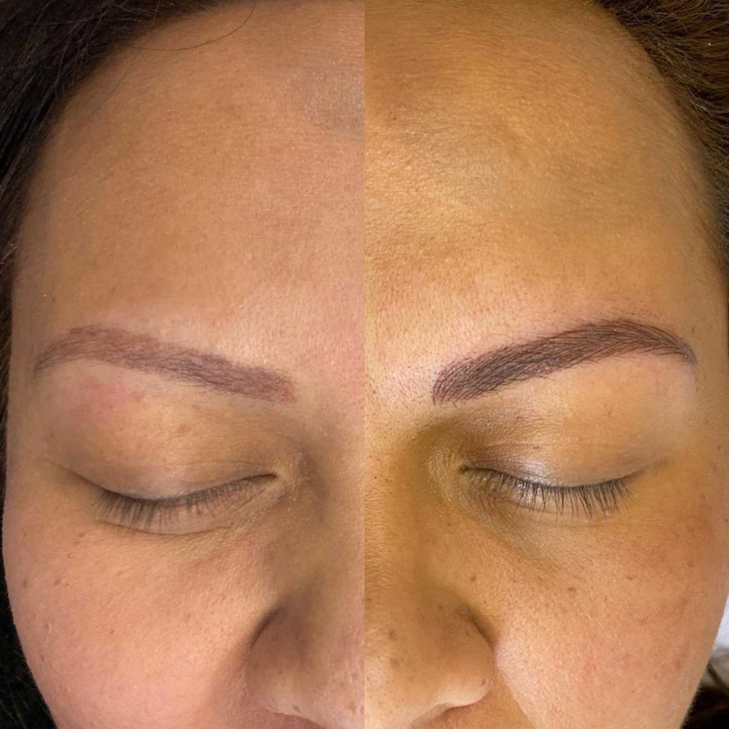 Eyebrow Tattoo Before and After Picture