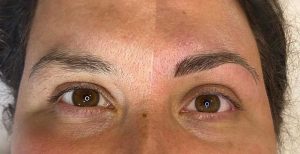 Image of Before and After Eyebrow Feathering