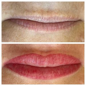 Cosmetic Lip Tattoo Before and After Image