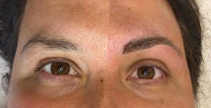 Before and After Image of Eyebrow Shaping