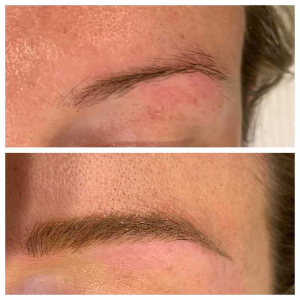 Eyebrow Microblading Before and After Image