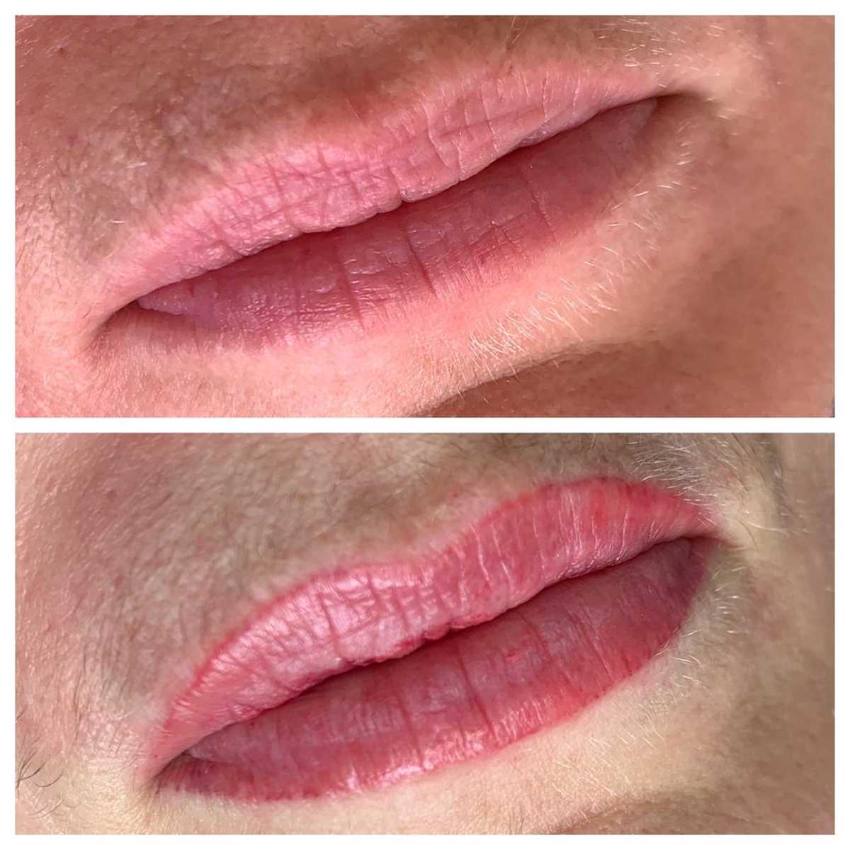 Cosmetic Lip Tattoo Before and After