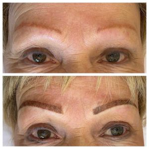 Eyebrow Tattoo Before and After