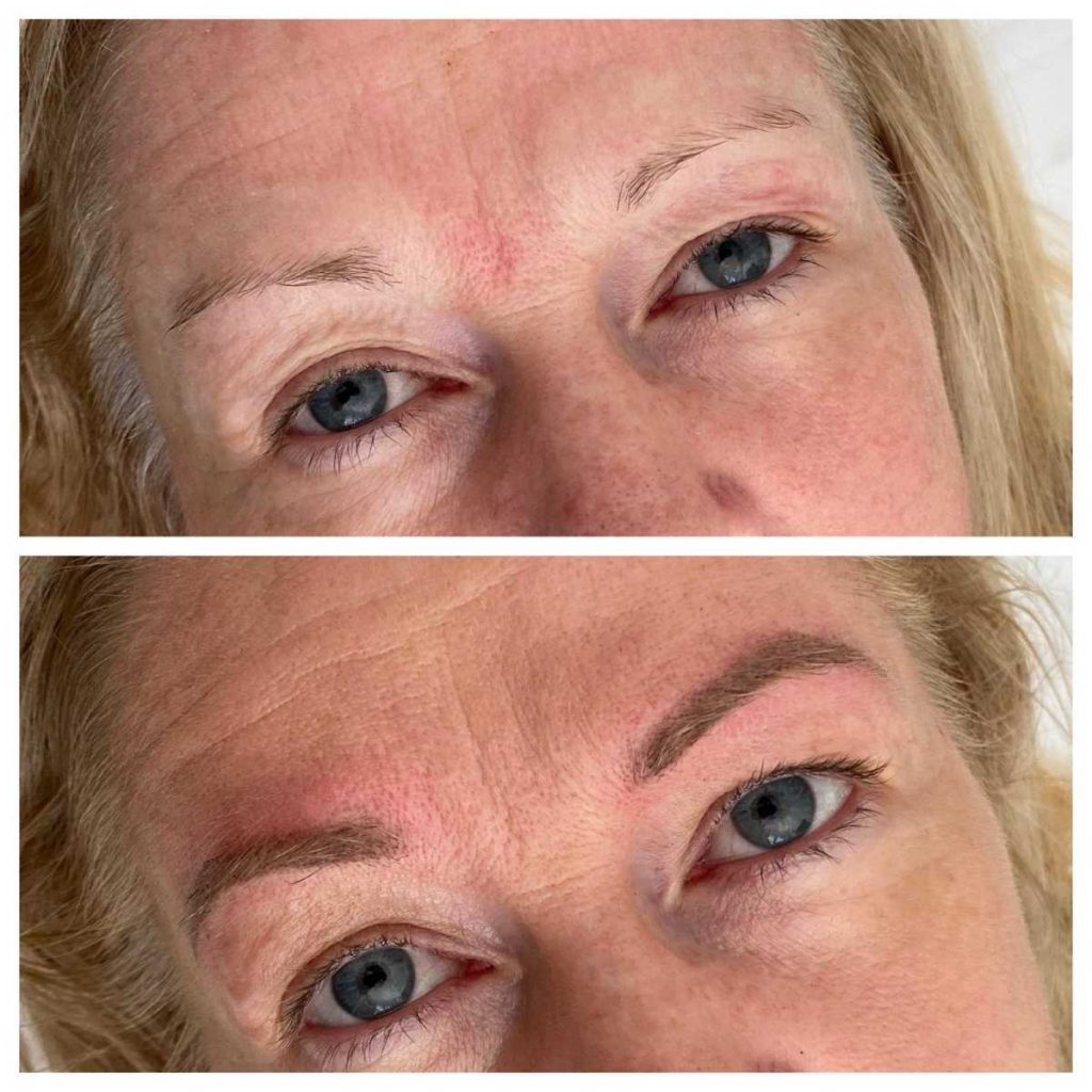 Before and After Eyebrow Cosmetic Tattoo