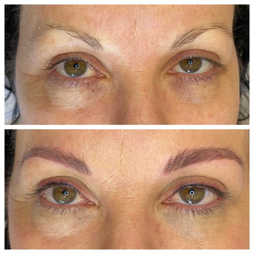 Before and After Image of Eyebrow Microblading