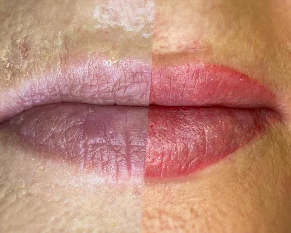 Image of Lip Tattoo Before and After