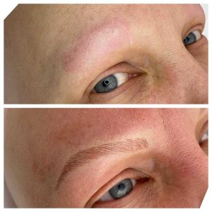 Before and After Photo of Eyebrow Microblading