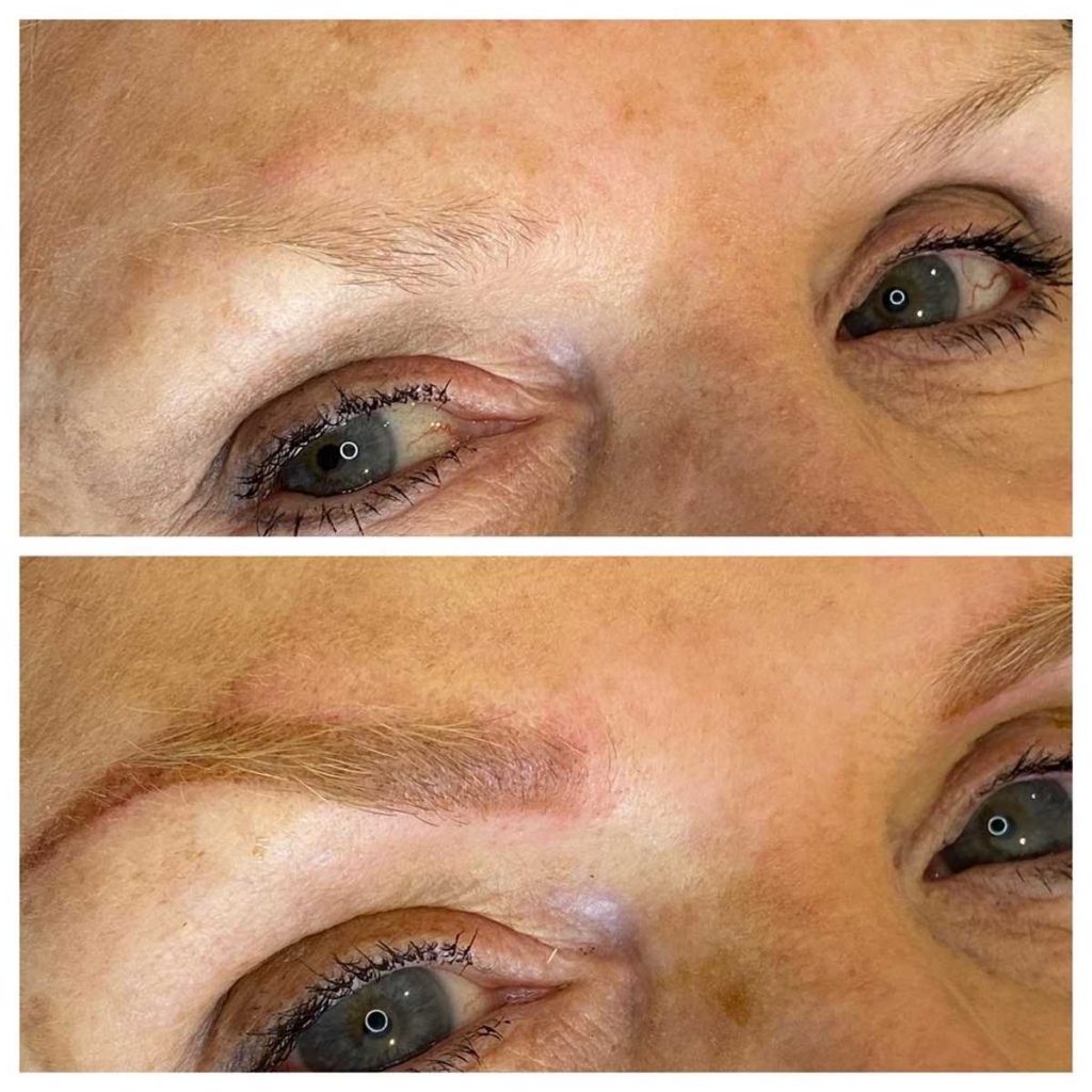 Eyebrow Tattoo Before and After Photo